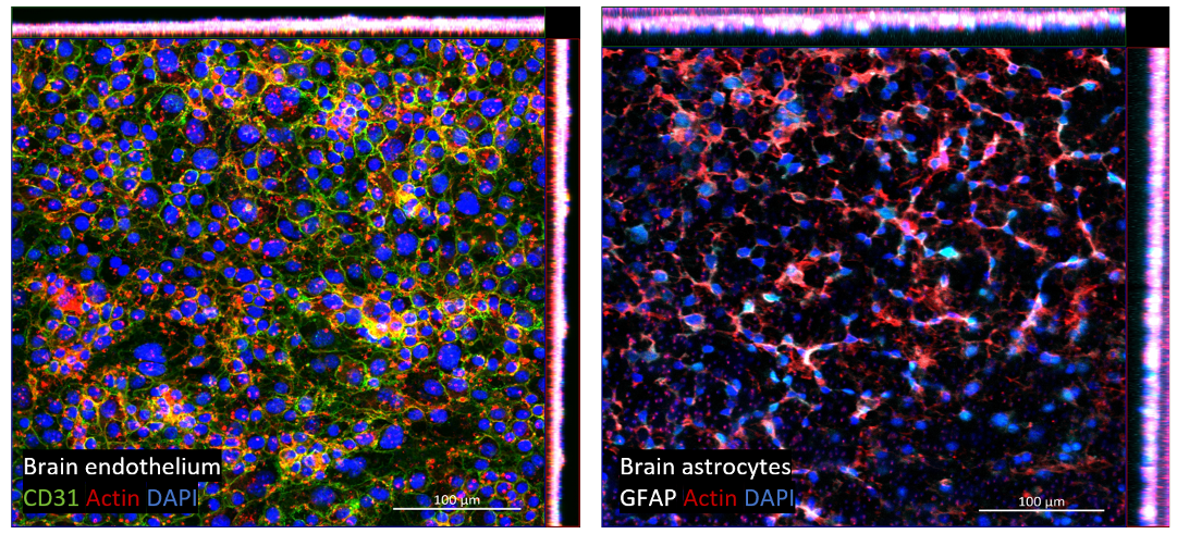 Confocal laser scanning imaging on Brain endothelium and brain astrocytes for the quality control and characterisation of a blood-brain-barrier model