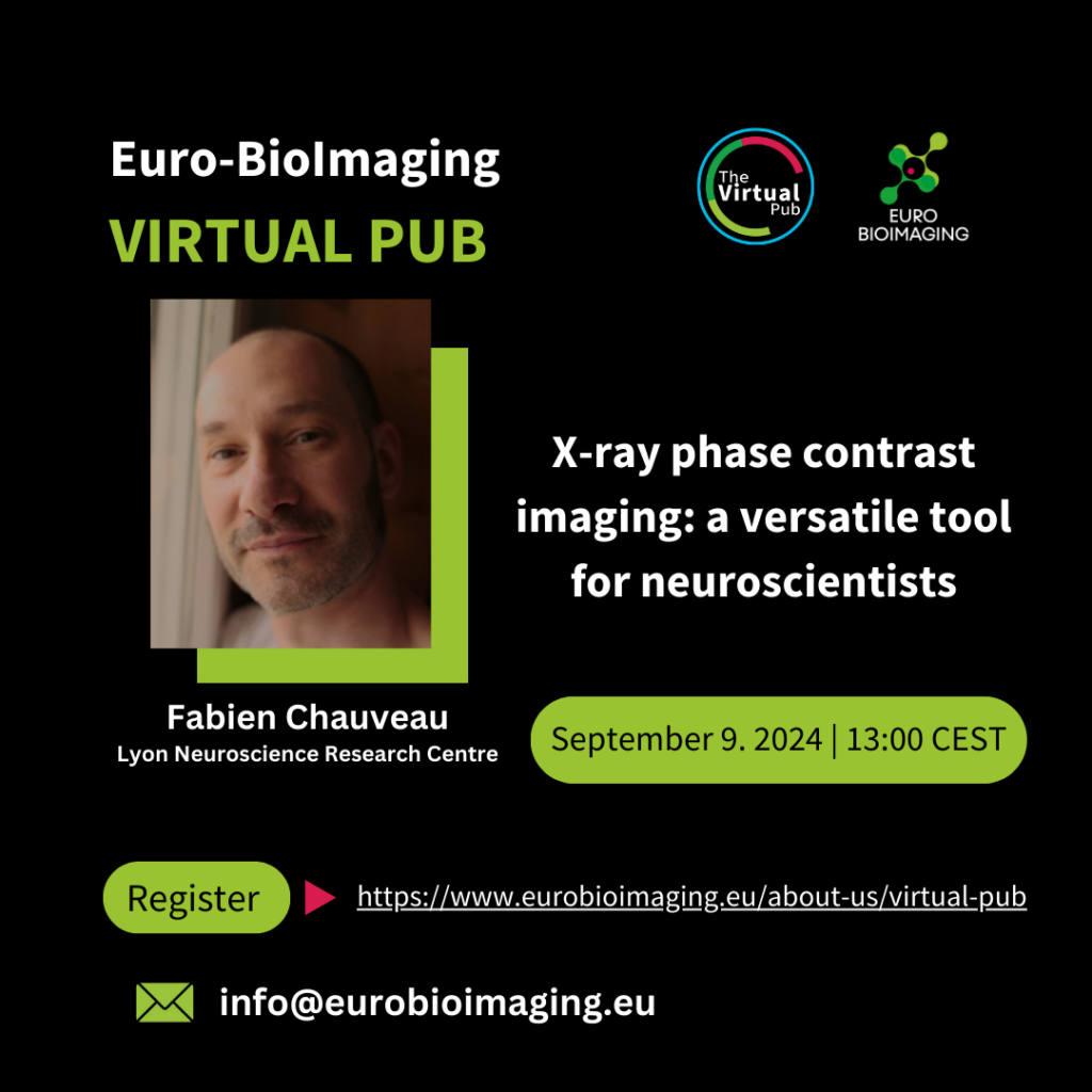 Please join us for the first Euro-BioImaging Virtual Pub of the fall 2024 season on Friday, September 6 at 13:00 CEST. 