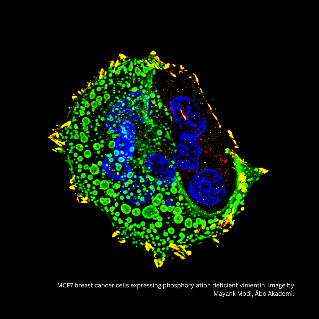 MCF7-breast-cancer-cells-expressing-phosphorylation-deficient-vimentin.-Image-by-Mayank-Modi-Abo-Akademi