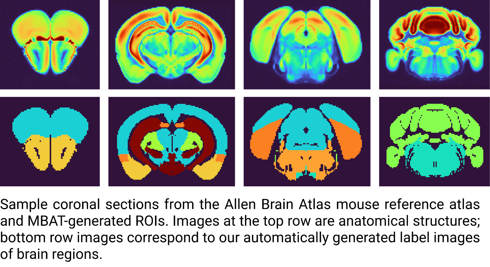 Mouse Brain Atlas screenshot
