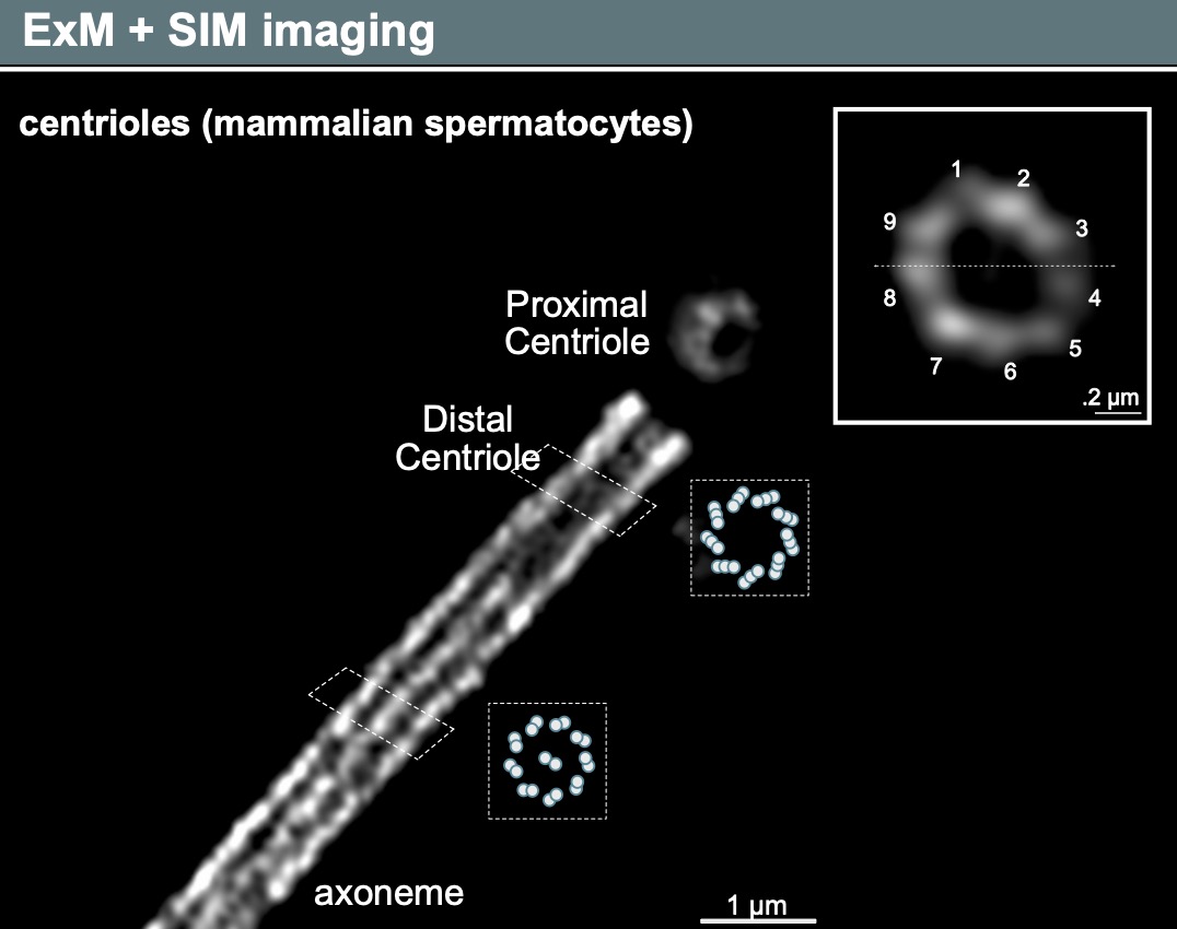 Expansion Microscopy and SIM image