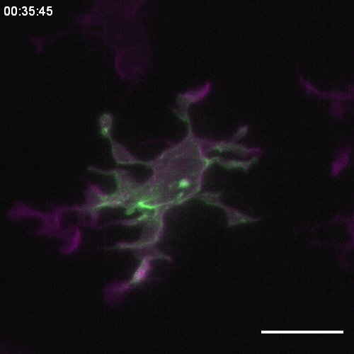 Cytoskeletal dynamics during microglia efferocytosis (microglia in magenta, F-actin in green). Image data are available in the BioImage Archive (http://www.ebi.ac.uk/bioimage-archive) under accession number S-BIAD564.