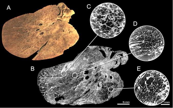 Photo of a lamella prepared for the study (A), a reconstructed slice of the entire tissue specimen at a resolution of 100 µm (B) and the outcomes of three local area scans performed in three selected areas (C-E) with a resolution of 5 µm